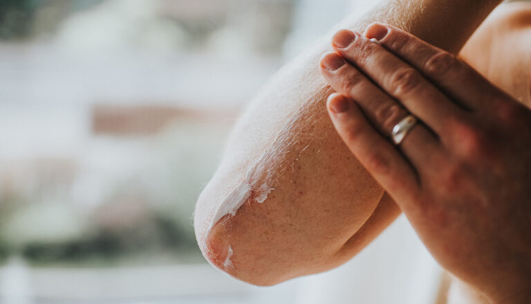 Male rubbing moisturising lotion on dry elbows and arm. Space for copy.
