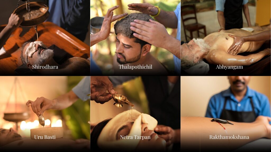 VVAC is india's best ayurvedic hospital offering several classical panchakarma treatments like uru basti, shirodhara, netra tarpan, abhyangam, and more