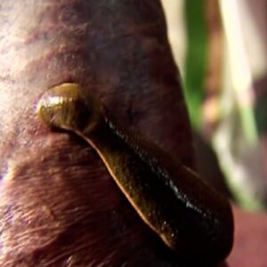 Jaloukavacharana, an ayurvedic leech therapy