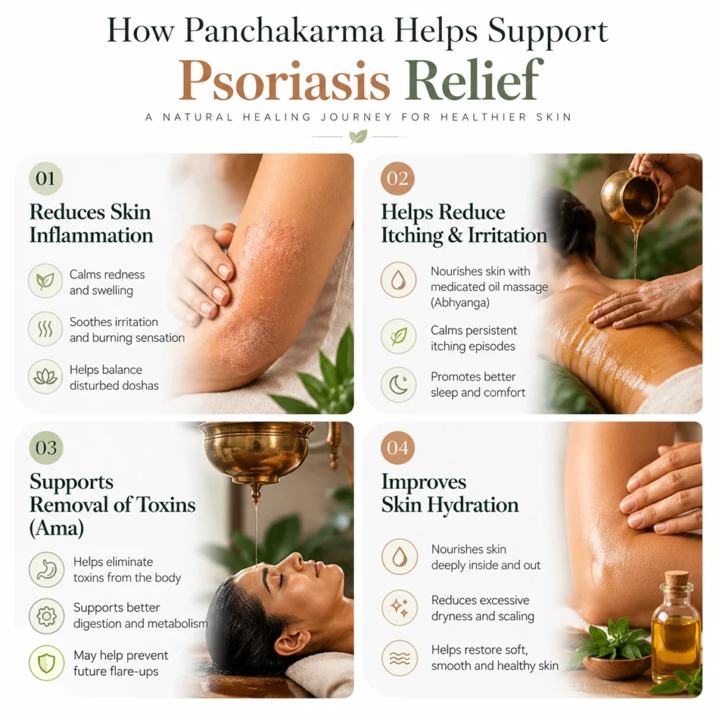 Ayurveda Therapy for Psoriasis Management